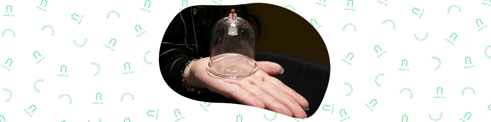 Terms Terms-alhadeh-hijama-on-face-for-acne-hijama-varicose-veins-hijama-hair-treatment-hijama-for-hair-hijama-for-knee-pain-hijama-for-kidney-failure