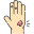 Wart