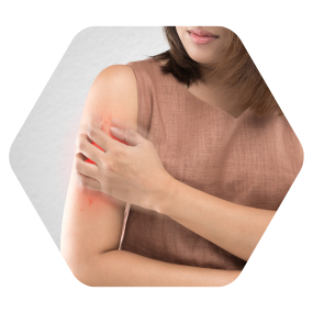 Hijama eczema cupping eczema cupping therapy for eczema hijama for eczema cupping eczema cupping therapy eczema wet cupping eczema cupping therapy and eczema hijama cupping for eczema best doctor for eczema in hyderabad best dermatologist in hyderabad for eczema eczema treatment in hyderabad cupping for eczema