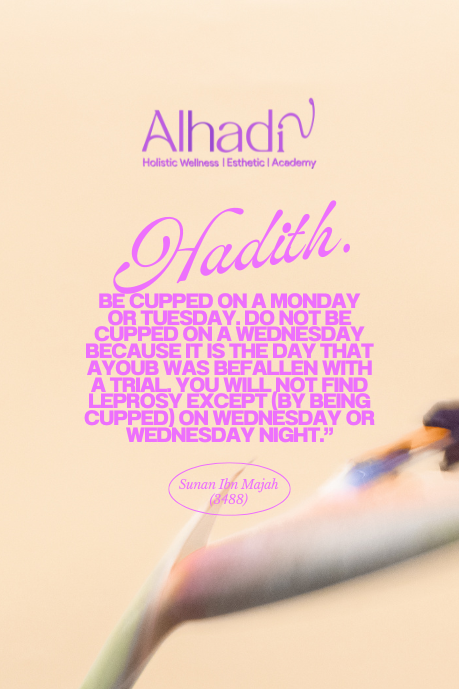 Best hijama centre in hyderabad for ladies cupping therapy hyderabad cupping therapy in hyderabad hijama centre hyderabad hijama clinic in hyderabad hijama treatment in hyderabad india hadith hijama hadith on hijama hijama hadees in urdu cupping hadith hijama hadees in hindi hijama wednesday hadith