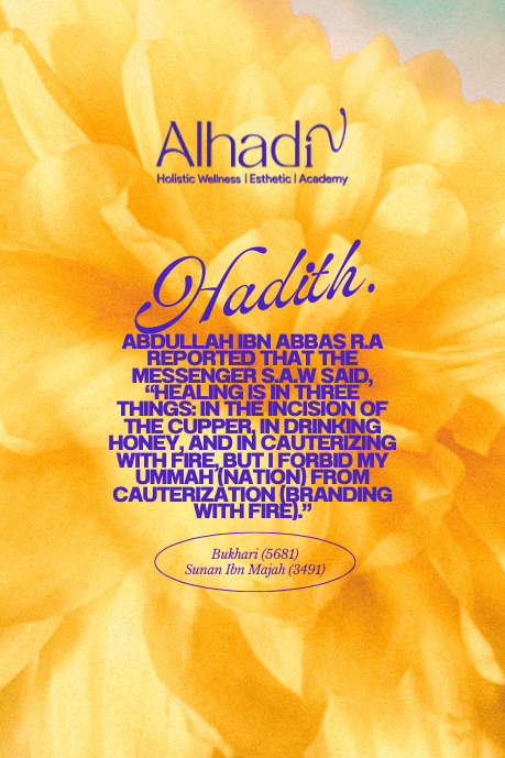 Alhadiv hijama in hyderabad hadith on cupping hijama in islam hijama hadith on hijama in hadith 6
