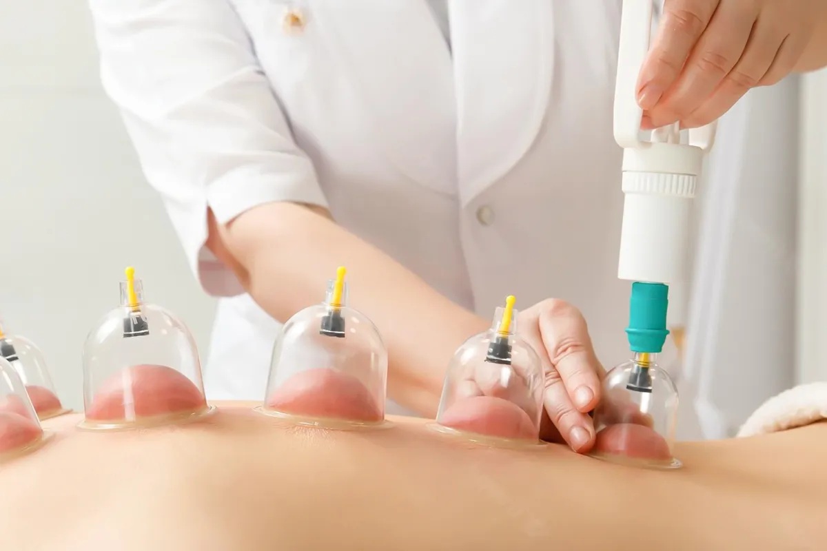 Alhadiv hijama specialist in hyderabad india applying hijama therapy to a client's back in a professional setting.