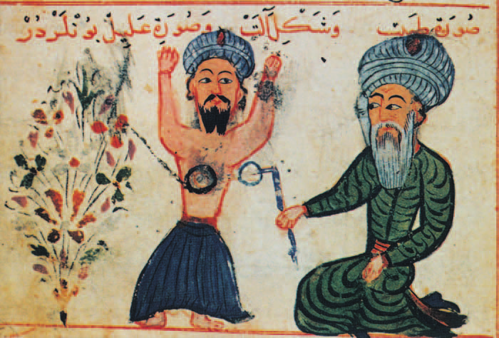Ancient medical illustration depicting the historical origins of traditional cupping therapy in hyderabad.