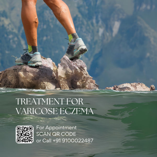 Best varicose veins doctor in hyderabad varicose vein treatment hyderabad telangana