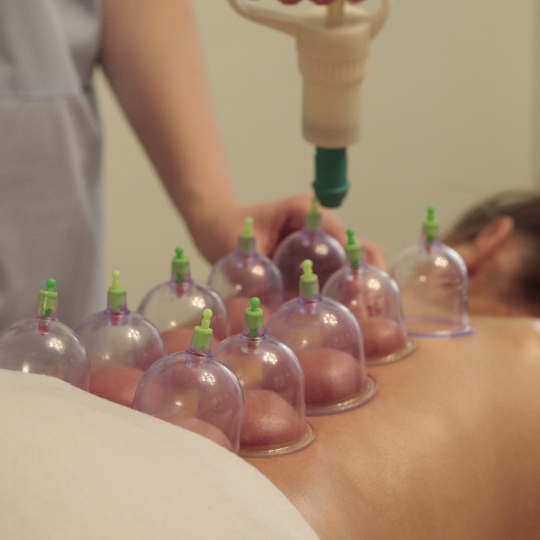 Cupping therapy for thyroid best thyroid doctor in hyderabad best thyroid specialist in hyderabad best hospital for thyroid in hyderabad best treatment for thyroid in india hijama therapy for thyroid