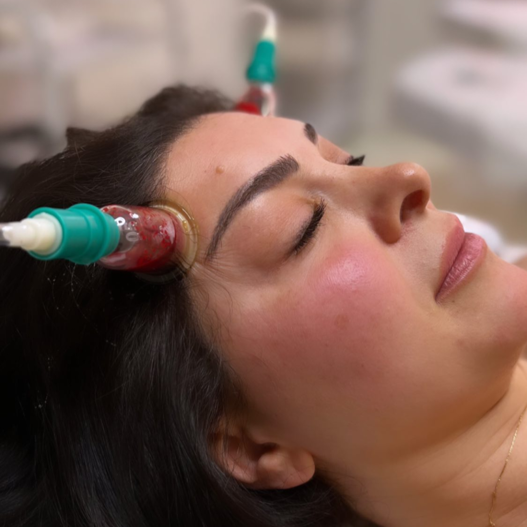 Chronic sinusitis treatment with cupping cupping for sinus specialist hyderabad