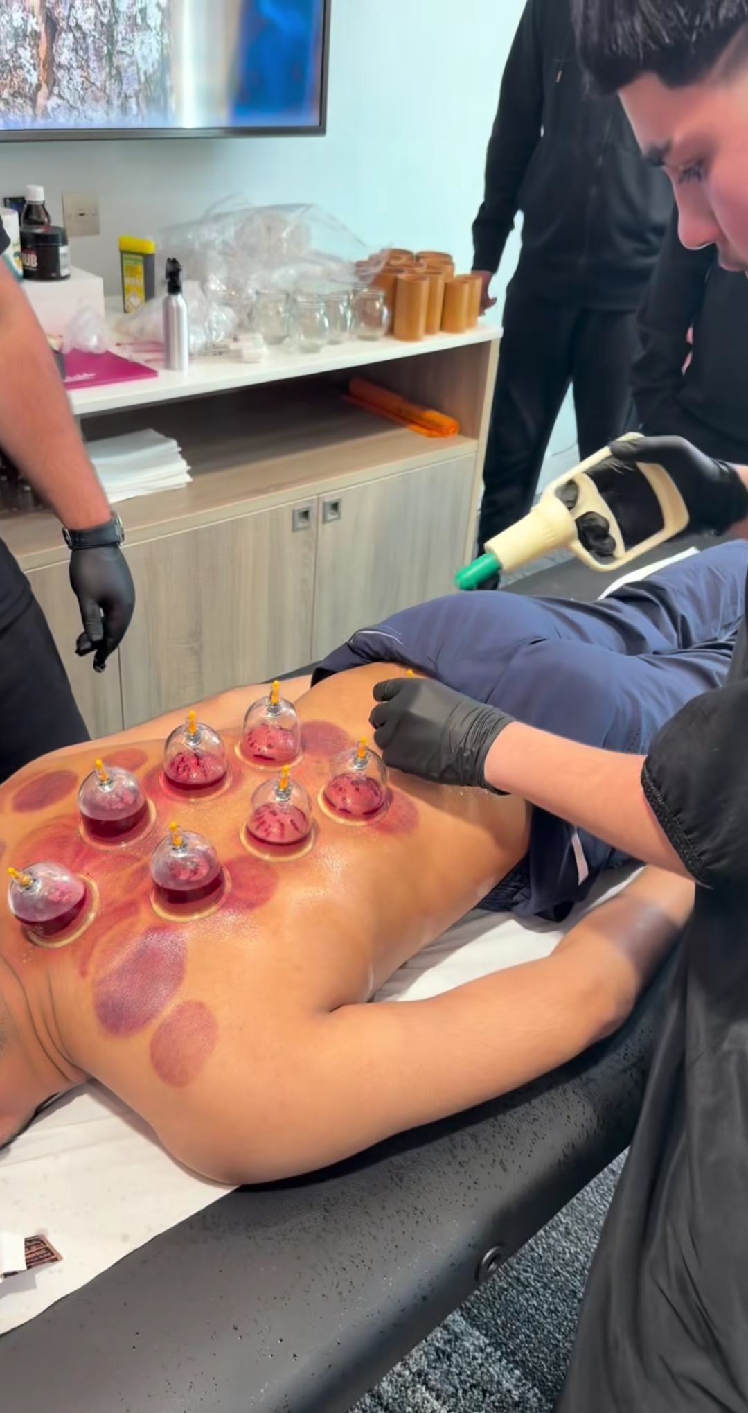 Best cupping certification for athletic trainers | offline & online cupping course 2026 – hands-on Earn the best cupping certification for athletic trainers with our flexible online cupping course and specialized sports cupping course.