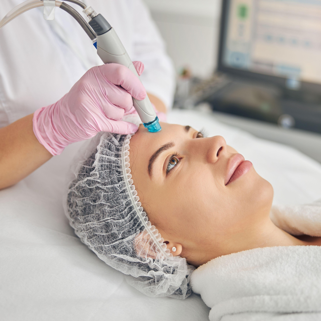 Skin laser treatments
